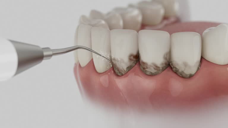 Reliable Tooth Extraction contractor in Odessa, TX by Smile Center Dentistry